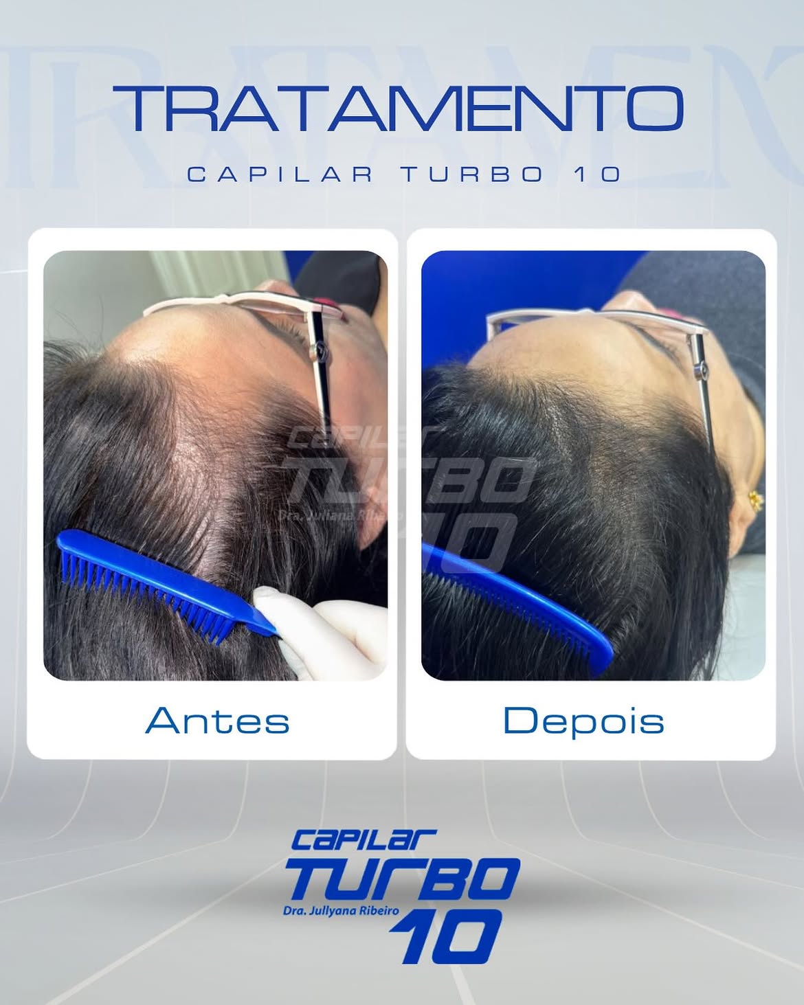 Tratamento, entradas capilares