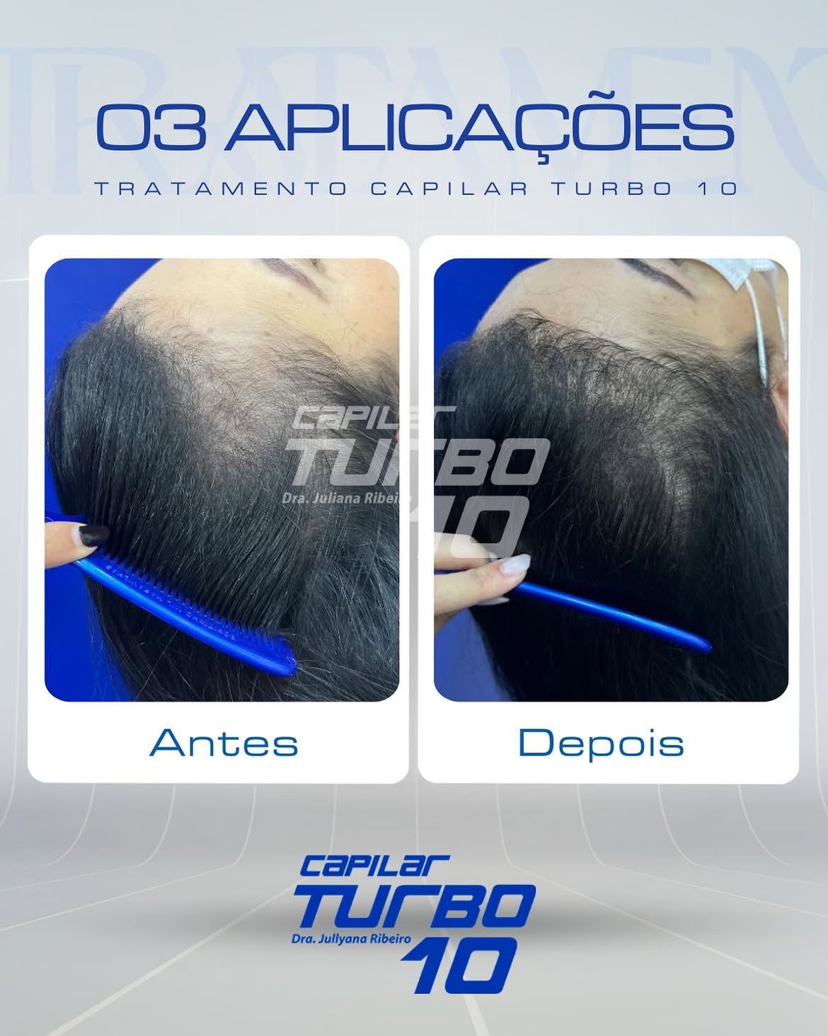 03 aplicações, entradas e falhas frontais
