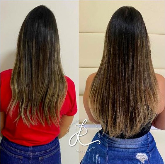 Antes e depois, volume e densidade capilar feminino