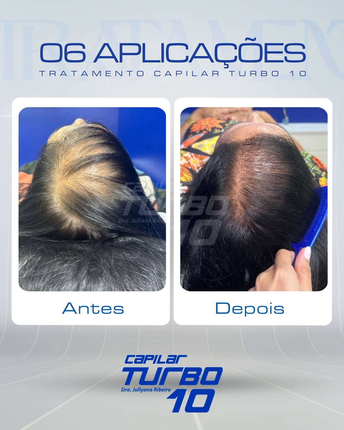 06 aplicações, densificação capilar