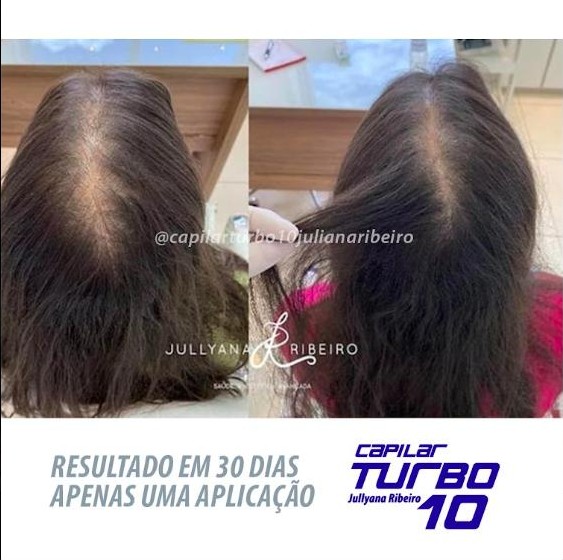Antes e depois, densidade em 30 dias, uma aplicação