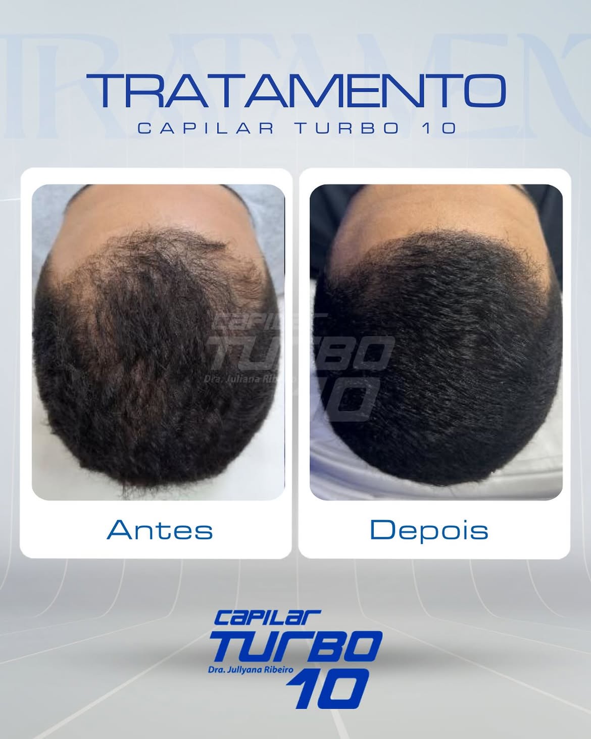Tratamento, preenchimento de entradas